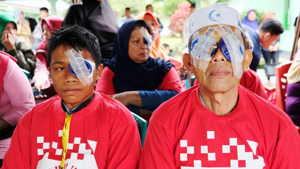 Operasi Katarak Gratis Tambang Emas Martabe Sukses